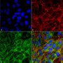 Secondary Antibodies